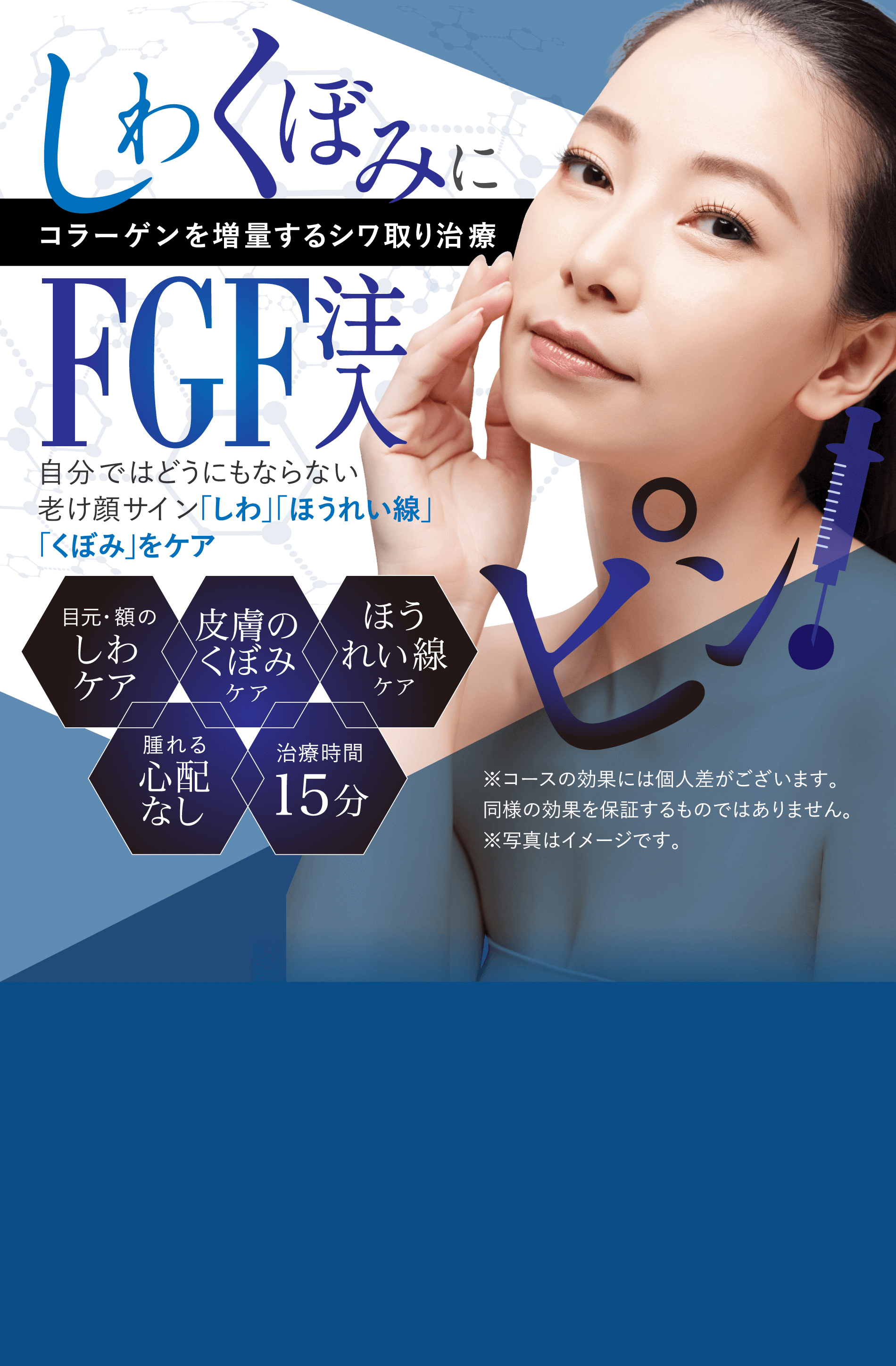 コラーゲンを増量するシワ取り治療自分ではどうにもならない老け顔サイン「しわ」「ほうれい線」「くぼみ」をケア※コースの効果には個人差がございます。同様の効果を保証するものではありません。※写真はイメージです。