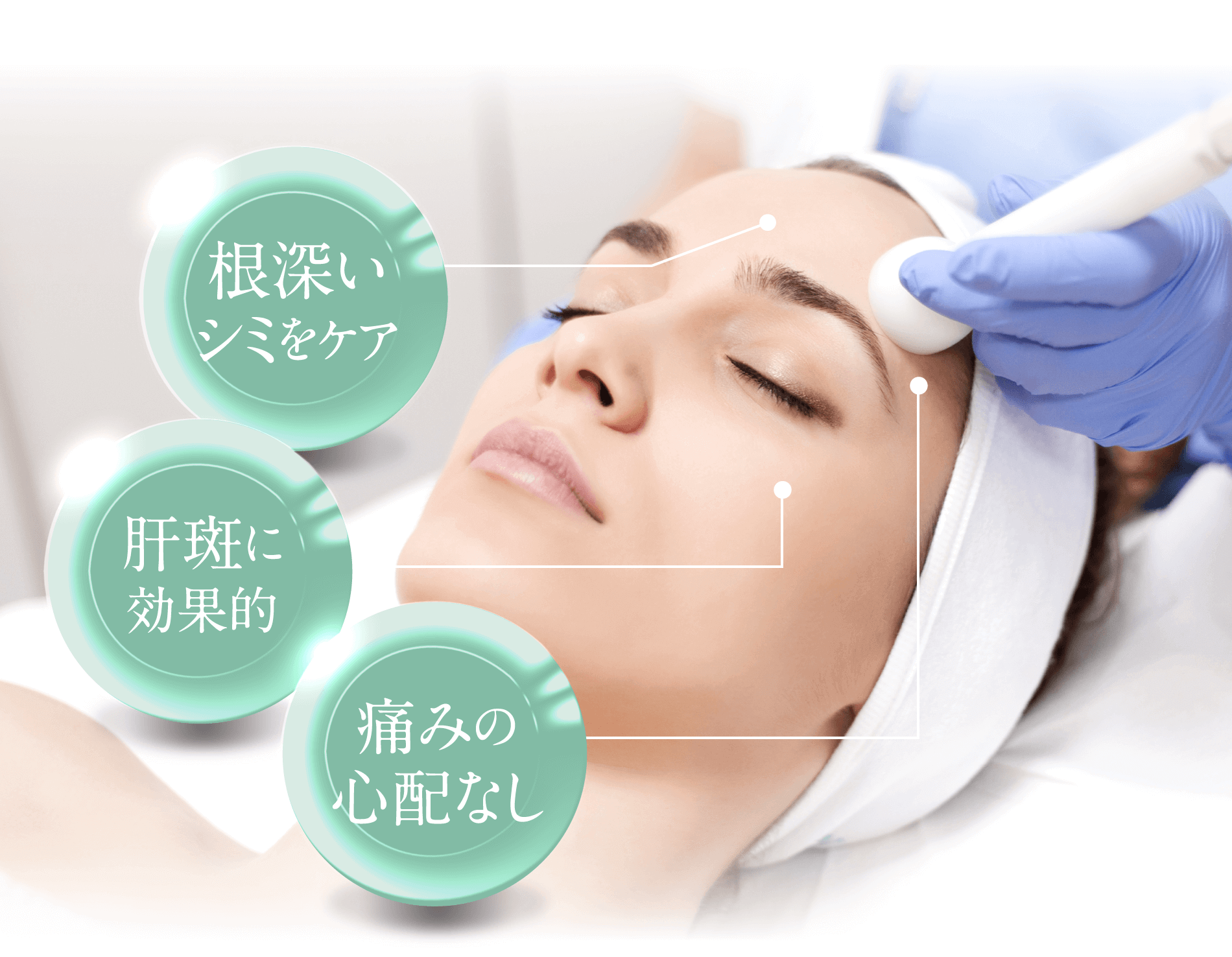 根深いシミをケア肝斑に効果的痛み心配なし